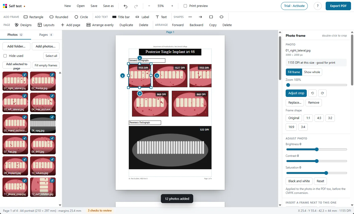 A photo frame selected, with resize handles, plus buttons to insert the next frame, and the frame settings panel