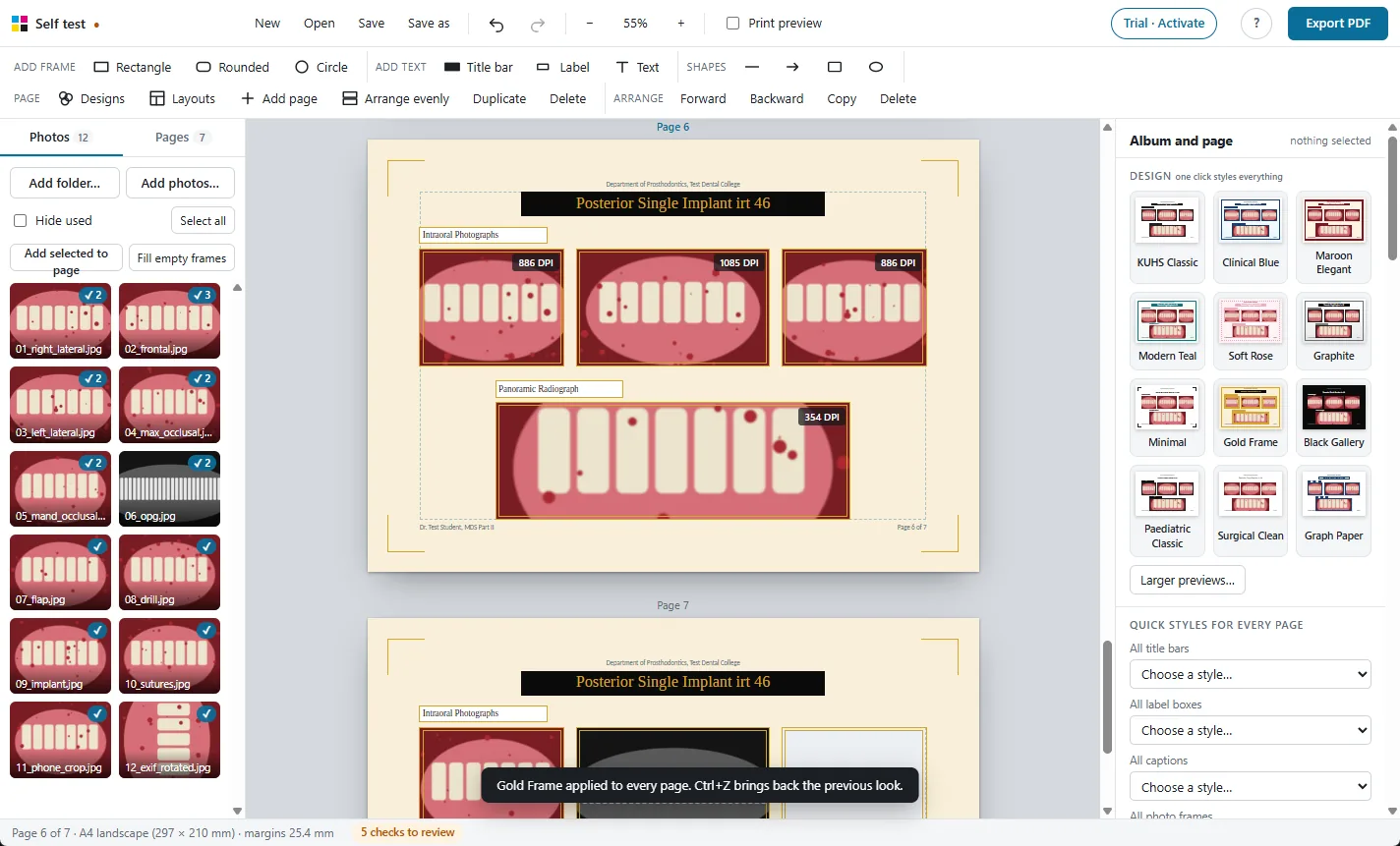 A landscape case page with a title bar, intraoral photographs and a panoramic radiograph in the Gold Frame design